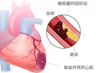 心臟病該怎么辦，且看臨床治療醫(yī)案一則